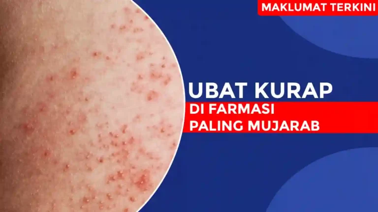 Ubat Kurap di Farmasi Paling Mujarab