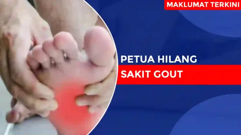 Petua Hilang Sakit Gout