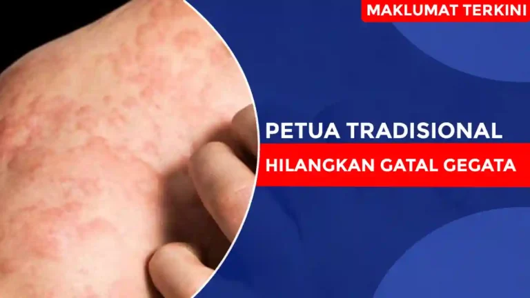 Petua Tradisional Hilangkan Gatal Gegata