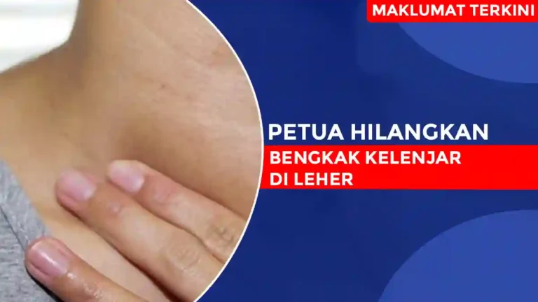 Petua Hilangkan Bengkak Kelenjar Di Leher