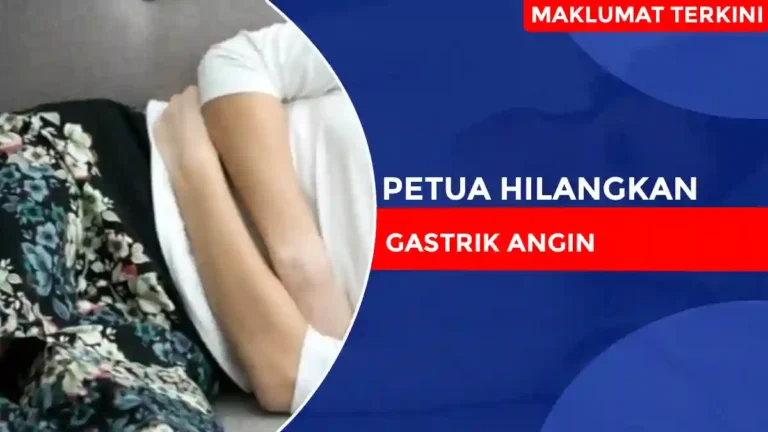 Petua Hilangkan Gastrik Angin